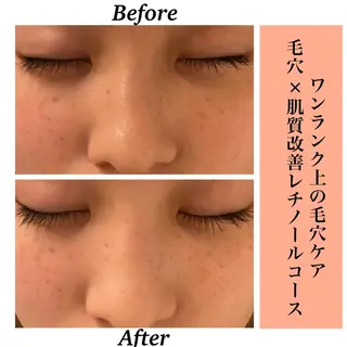 Bellesthe (ベルエステ)のエステ・リラクイメージ