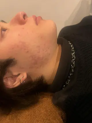 メンズ 美容鍼灸サロン LOMIHARIのエステ・リラクイメージ