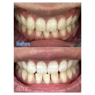 MBEAUTYSALON 千葉店・京成大久保所属・Melty 輝のその他イメージ