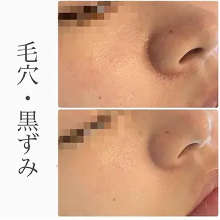 ハーブピーリング専門 BIOEL横浜のエステ・リラクイメージ