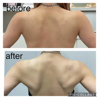 ENCHANT 脱毛.小顔.毛穴のエステ・リラクイメージ