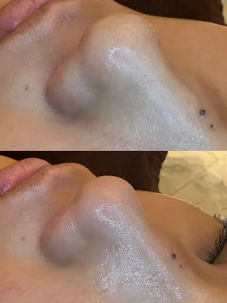 EARTH coiffure beaute 新潟紫竹山店所属・🤍アベシュリ /フェイシャル🤍のエステ・リラクイメージ