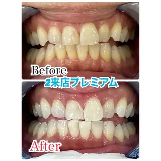 カラー マツエク・マツパ プラチナムビューティー柏所属・【歯科提携】柏ホワイ トニングスタイルのその他イメージ