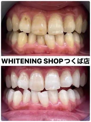 ホワイトニングショップつくば店所属・ホワイトニング ショップつくば店のその他イメージ
