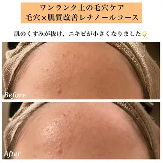 Bellesthe (ベルエステ)のエステ・リラクイメージ