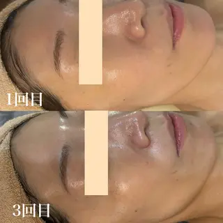 WHITE AQUA 北千住店のエステ・リラクイメージ