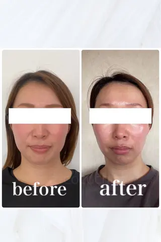 小顔と ヘッドスパのお店のエステ・リラクイメージ