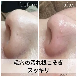 ECXIA 【エクシア】のエステ・リラクイメージ