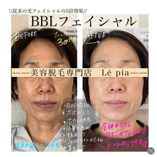 肌質管理専門店 Lé pia　AMIのエステ・リラクイメージ