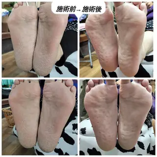 ネイル RENAIL  玲奈のネイルデザイン
