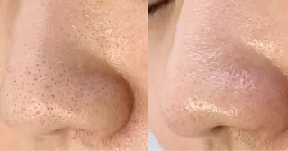 メンズ salonLADYSTYLE所属・稲嶺 美華のエステ・リラクイメージ