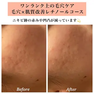 Bellesthe (ベルエステ)のエステ・リラクイメージ