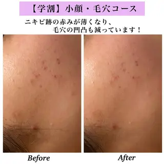 Bellesthe （ベルエステ）のエステ・リラクイメージ