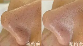 private salon Dea_maris シュガーリング&パーソナルボディケア所属・シミ改善・韓国肌管理 ボディメイク痩身のその他イメージ