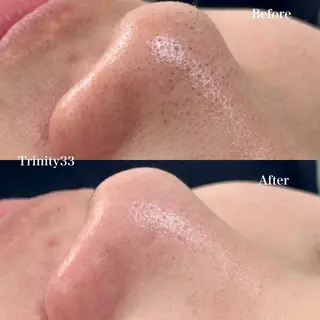 Liber Kyoto所属・魔法のシミ取り職人 CHIKAのマツエク・マツパデザイン