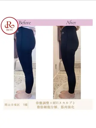 アンテインチル 山本のエステ・リラクイメージ