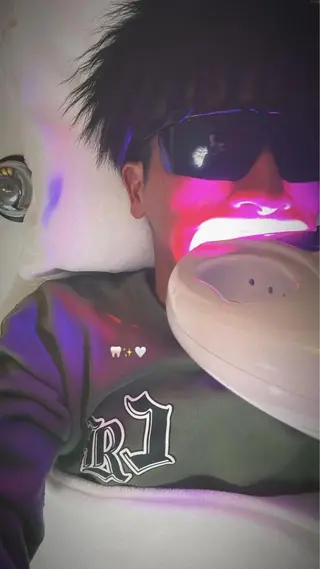 メンズ プラチナムビューティー柏所属・【歯科提携】柏ホワイ トニングスタイルのその他イメージ