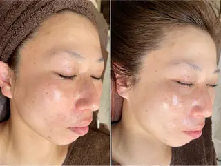 脱毛和みサロン新茶屋所属・脱毛和みサロン新茶屋 ひろみ（女性専用）のエステ・リラクイメージ