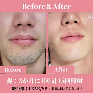 メンズ 有人型セルフサロン 脱毛/痩身/美顔のその他イメージ