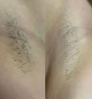 うえつま ふみえのエステ・リラクイメージ