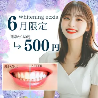 セルフホワイトニング エクシア天神店のその他イメージ
