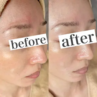 WHITE AQUA 北千住店のエステ・リラクイメージ