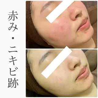 ハーブピーリング専門 BIOEL横浜のエステ・リラクイメージ