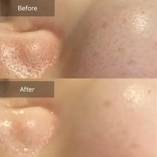 Mandarin Orange所属・毛穴から始める肌メン テマンダリンオレンジのエステ・リラクイメージ