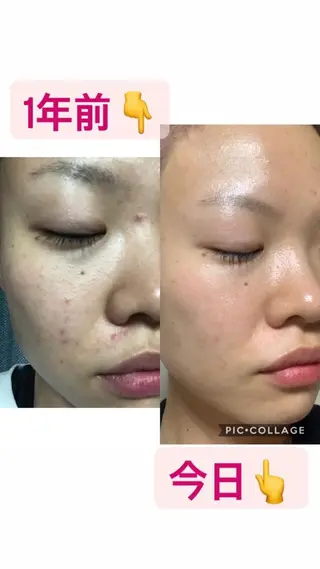 ミディアム ヒーリングサロン メリッサ/tooSMILE所属・大屋 詩織のエステ・リラクイメージ