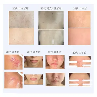 ベラージュ【美背中・ 美尻・フェイシャル】のエステ・リラクイメージ