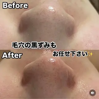 プライベートサロン Belle（ベル）のエステ・リラクイメージ