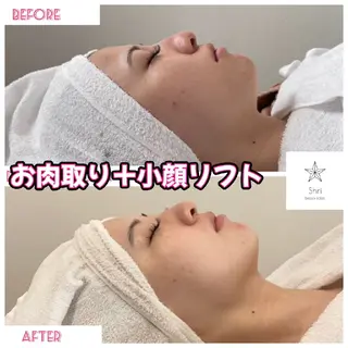 salon Lewis Addict所属・ルイスアディクト 名駅店のエステ・リラクイメージ