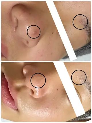 キッズ Beauty SalonAeriのエステ・リラクイメージ