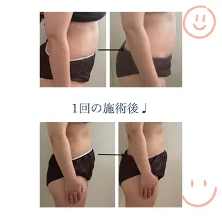 深層リンパドレナージュ ＆産前産後マッサージサロンShe所属・リンパドレナージュ＆ 産前産後サロンSheのエステ・リラクイメージ