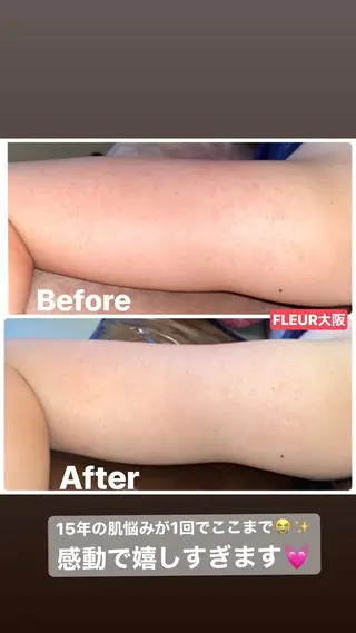 FLEUR大阪・整体 ・ハイフ・痩身・小顔のエステ・リラクイメージ