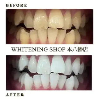 メンズ ホワイトニング ショップ本八幡店のエステ・リラクイメージ