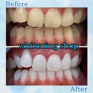 ホワイトニング ショップ葛西店のその他イメージ