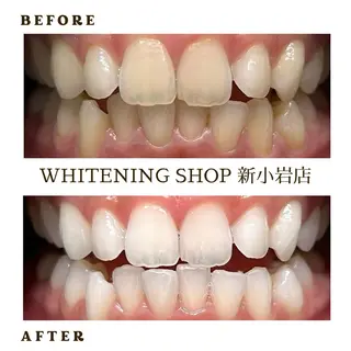 メンズ ホワイトニング ショップ新小岩店のその他イメージ