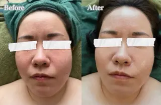 【Salon D】 HALUのエステ・リラクイメージ