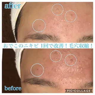 ショート カラー パーマ ヘアアレンジ キッズ ネイル マツエク・マツパ Ensor Clair所属・EnsorClair 代表 野口真央のエステ・リラクイメージ