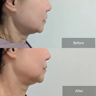 nail RiRi アトレナチュラのエステ・リラクイメージ