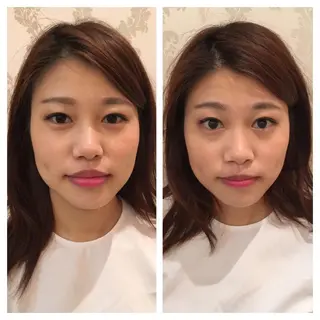 美容鍼サロン    Fleurir所属・伊藤 かなえのエステ・リラクイメージ