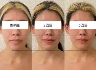 小顔/たるみ/黒ずみ除去専門サロン/SONA 大和西大寺店所属・【小顔専門看護師 サロンSONA】のエステ・リラクイメージ