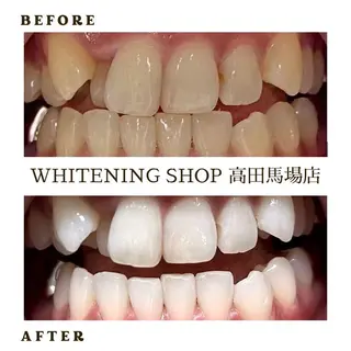 メンズ ホワイトニング ショップ高田馬場店のその他イメージ