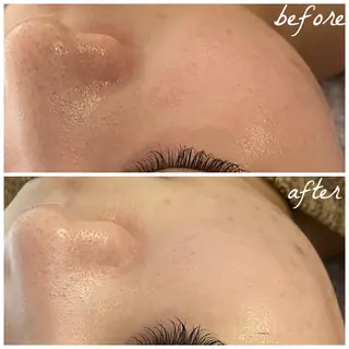 メンズ メナード岐阜茜部 杉浦のエステ・リラクイメージ