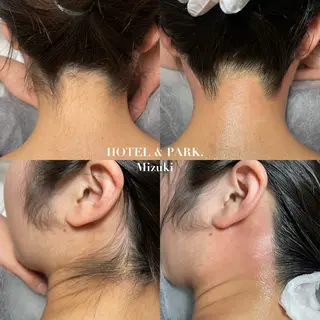 HOTEL&PARK . ワックス脱毛のエステ・リラクイメージ