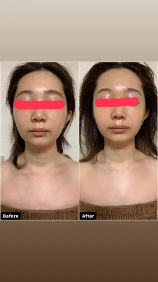 透明感の肌Lino malieのエステ・リラクイメージ