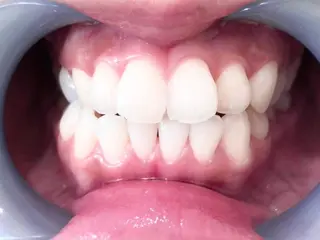 セルフホワイトニングサロン　ラヴィアン所属・ホワイトニングサロン La vie enのその他イメージ