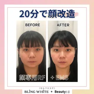 BLINGWHITE +Beauty iSのエステ・リラクイメージ