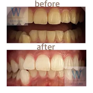 ホワイトニング ショップ本八幡店のエステ・リラクイメージ